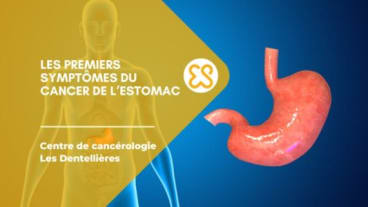 Les premiers symptômes du cancer de l'estomac
