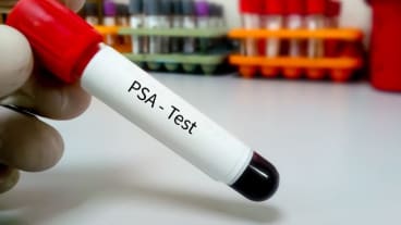 A partir de quel taux de PSA faut-il s'inquiéter ? Image d'un tube de laboratoire rempli de sang destiné à un dosage du PSA.