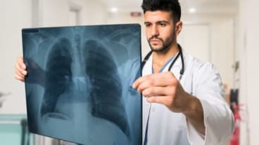 Comment savoir si un nodule au poumon est cancéreux ? Un médecin examine une radiographie des poumons.
