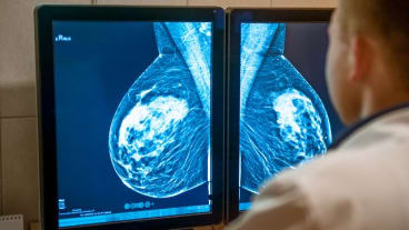 Quel examen pour détecter un cancer ? Un soignant étudie des images issues de mammographie.