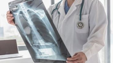 Quels sont les premiers symptômes d'un cancer des os. Un soignant examine une radiographie du thorax et des poumons.