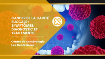 Cancer de la cavité buccale - Symptômes, diagnostic et traitements