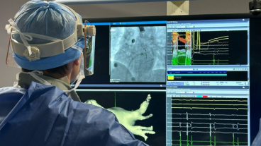 La clinique Saint-Vincent s’est équipée d’une technologie qui permet de réaliser les premières ablations de fibrillation atriale