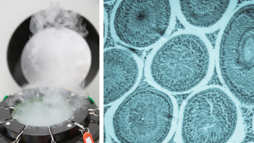 Congelation des ovocytes