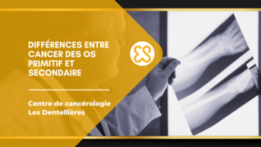 Différences entre cancer des os primitifs et secondaires