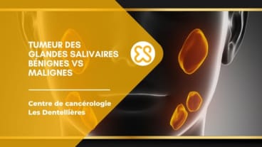 Tumeur des glandes salivaires : bénignes vs malignes
