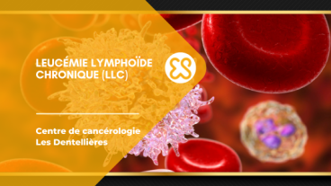 Leucémie lymphoïde chronique (LLC)