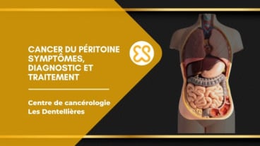 Cancer du péritoine – symptômes, diagnostic et traitement
