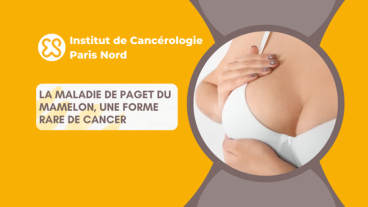 La maladie de Paget du mamelon, une forme rare de cancer