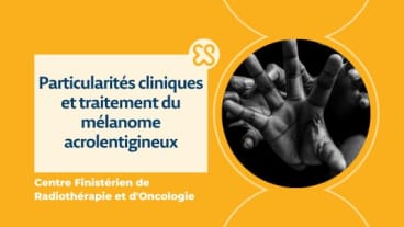 Particularités cliniques et traitement du mélanome acrolentigineux