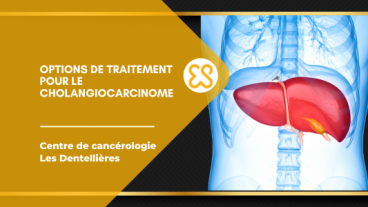 Options de traitement pour le cholangiocarcinome
