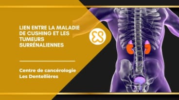 Lien entre la maladie de Cushing et les tumeurs surrénaliennes