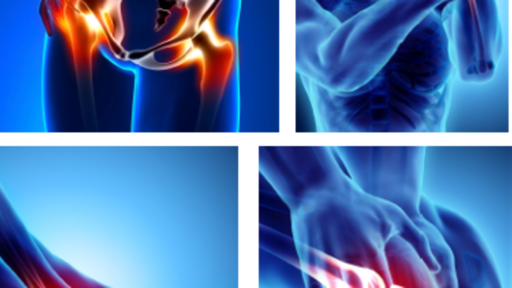 image formation
