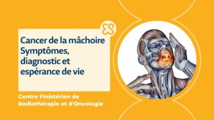 Cancer de la mâchoire, symptômes, diagnostic, espérance de vie