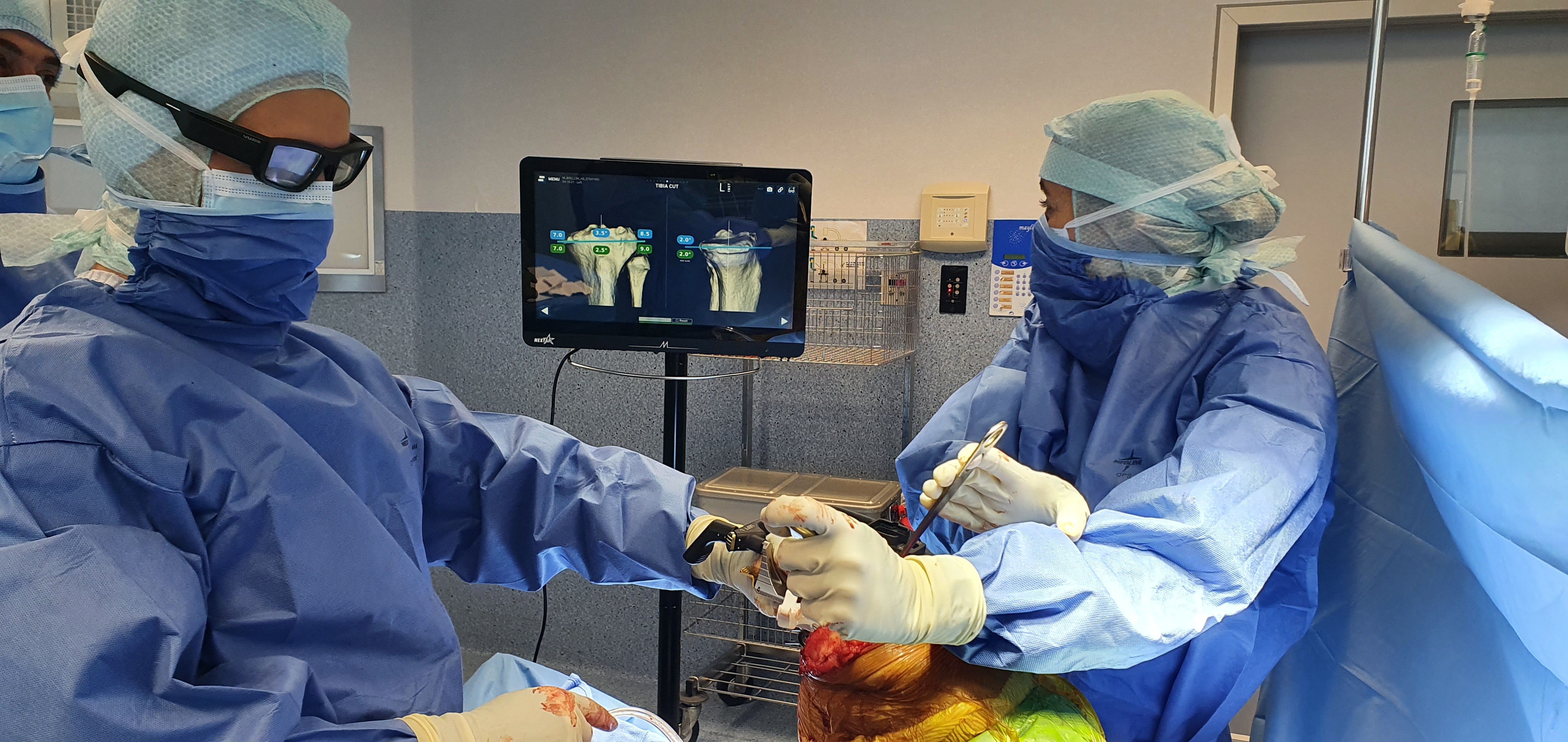 prothèses de genou medial-pivot à l' aide de la réalité augmentée Medacta NextAR