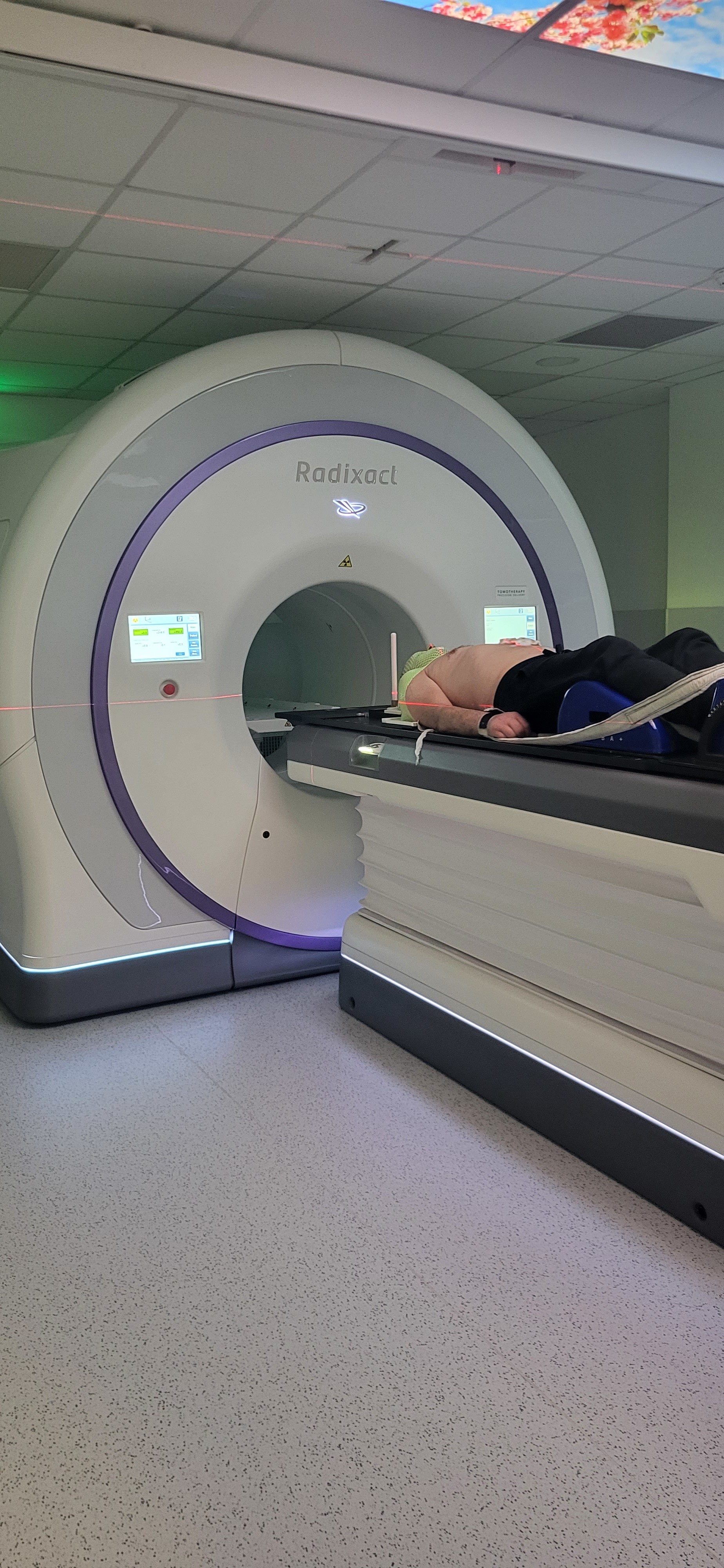 1er patient Radixact Les Dentellières