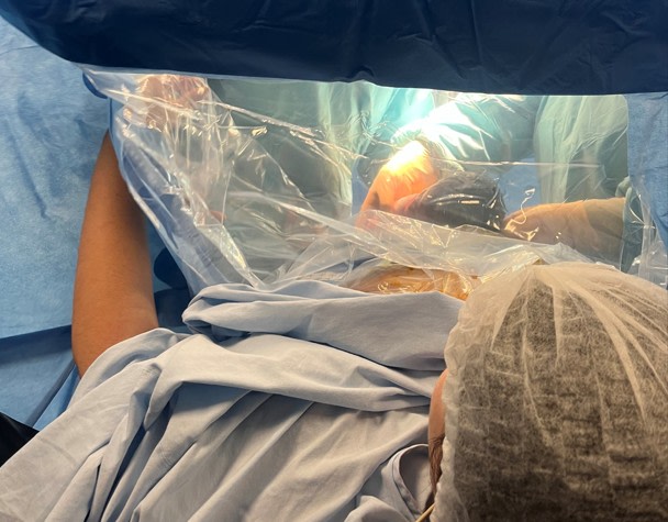 Césarienne participative, voir et vivre mieux son accouchement...