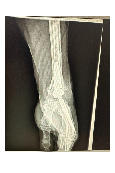 Prothèse de poignet