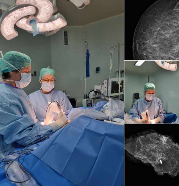 dr pirlet cancer sein elsan