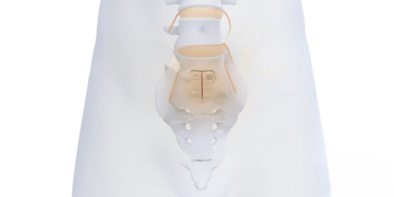 Arthrodèse voie antérieure