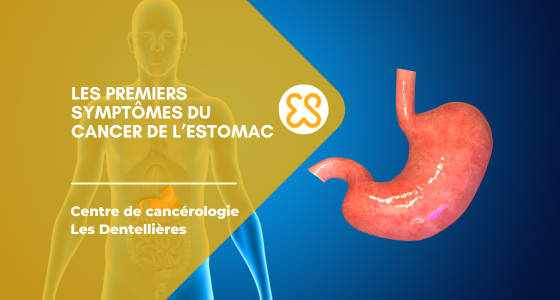 Les premiers symptômes du cancer de la mâchoire