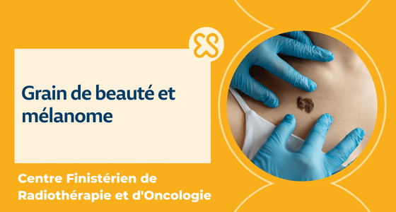 Mélanome et grain de beauté
