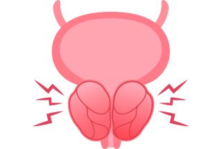 Illustration dune prostate en douleur