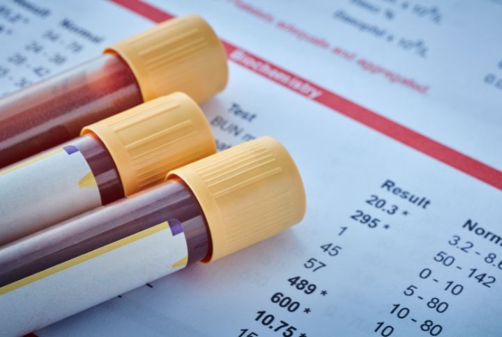 NFS : numération formule sanguine ou hémogramme : tubes de sang sur une feuille de résultats d'examen sanguin.