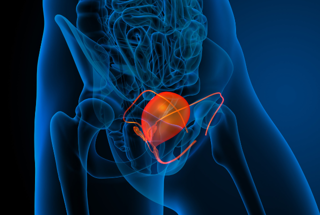anatomie , du corp avec différents organe visible et un axe sur la vessie pour opération avec Robot Da Vinci