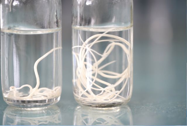 Vers intestinaux ronds Ascaris dans des verres remplis de solution. Ils provoquent l'ascaridiose.