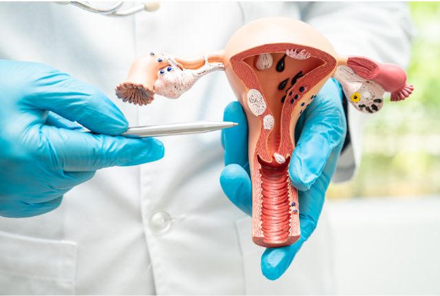 Cancer du col de l'utérus : un soignant pointe le col sur une maquette anatomique.