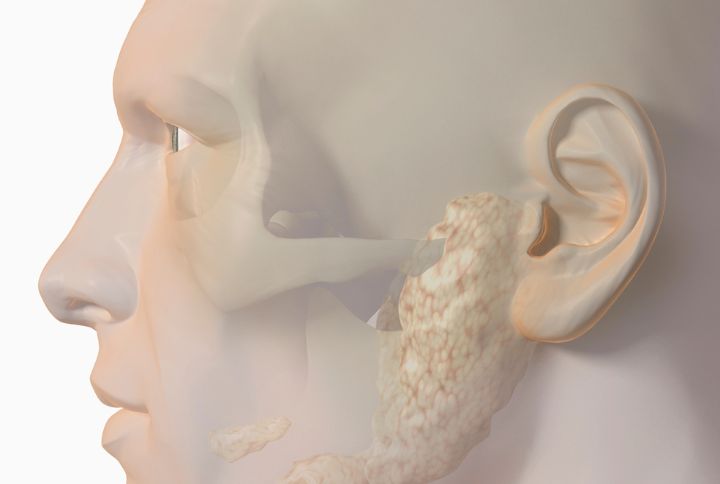 Cancer des glandes salivaires : définition, symptômes, chances de survie. Image en 3D d'une tête humaine où sont figurés les glandes salivaires sous l'oreille et le long de la mâchoire.
