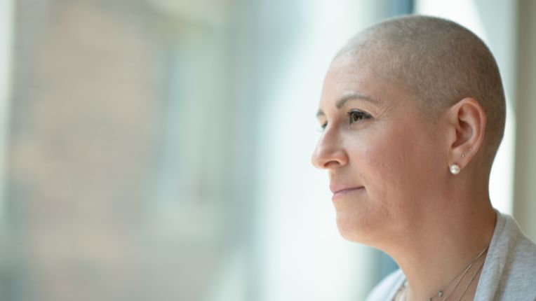 Cas de cancer en France 2025 : chiffres, classements et prévention. Portrait d'une patiente dont le crâne est rasé.