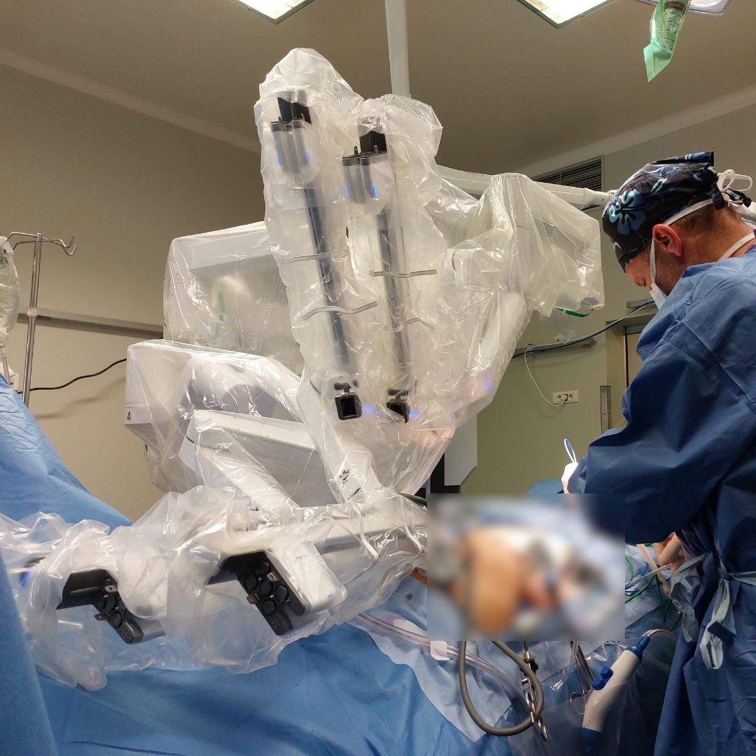 Les bras du robot Da Vinci X