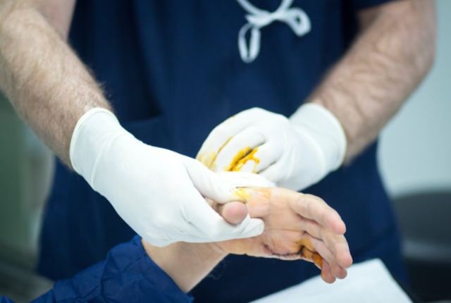 Chirurgie de la main pour les patients étrangers en France : un soignant tient la main de son patient au bloc opératoire.