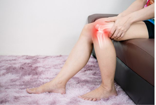 Chondrocalcinose : image figurant l'inflammation de l'articulation du genou d'une femme.