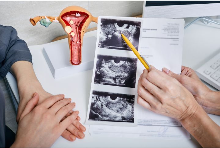 Comment avez-vous découvert votre cancer des ovaires ? Une gynécologue montre des images médicales de ses ovaires à une patiente.