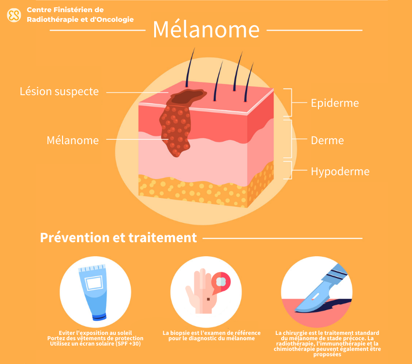 infographie mélanome cancer de la peau