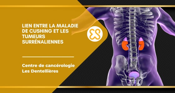 Lien entre la maladie de Cushing et les tumeurs surrénaliennes