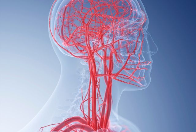 Artères du cou et de la tête. La maladie de Horton est une vascularite des artères du cou et de la tête.
