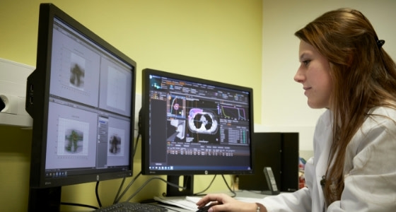 Oncologue cancer langue