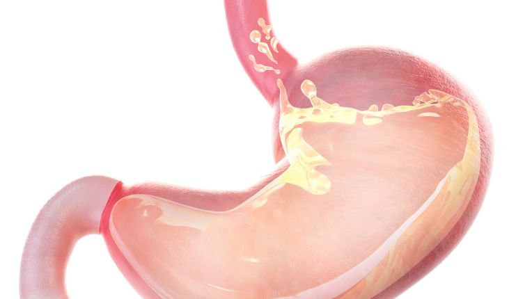 Opération du cardia par robot à Brest. Image de synthèse de l'estomac avec le flux gastrique qui arrive par le haut. En haut, à la jonction entre l'œsophage et l'estomac, se trouve le cardia.