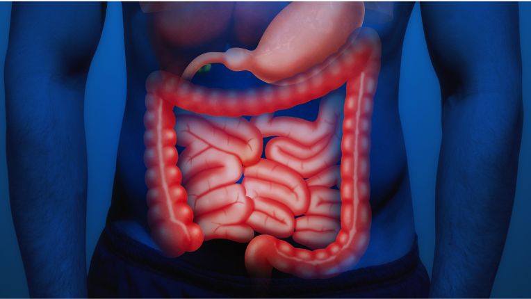 Opération de l’intestin par robot à Agen. Image de synthèse figurant l'emplacement de l'intestin dans l'anatomie humaine.