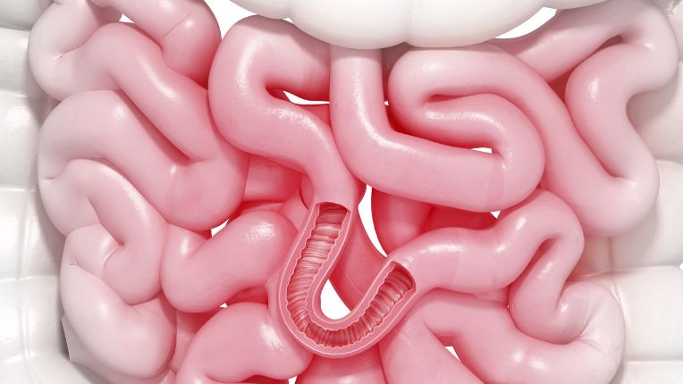 Opération de l'intestin grêle par robot à Toulouse. Image de synthèse en 3D d'un intestin grêle ou petit intestin.