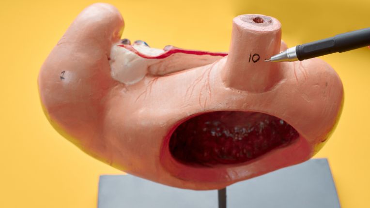 Opération de l’œsophage par robot à Toulouse. Un soignant pointe avec son stylo sur un modèle anatomique, la jonction entre l'œsophage et l'estomac, via le cardia.