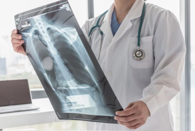 Quels sont les premiers symptômes d'un cancer des os. Un soignant examine une radiographie du thorax et des poumons.