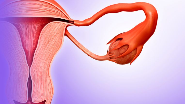 Dessin scientifique d'une trompe de Fallope, cible de la salpingite (infection bactérienne).