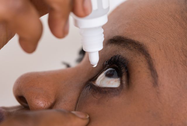 Femme mettant des gouttes dans les yeux. Le syndrome de Gougerot-Sjögren se manifeste par une sécheresse oculaire notamment.