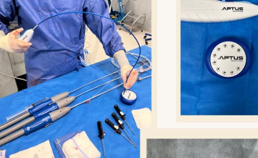 l’utilisation du système HÉLICE (M    edtronic).