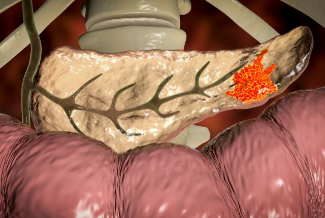 Nouveau test sanguin du cancer du pancréas : image de synthèse du pancréas, glande allongée d'une quinzaine de centimètres placée derrière l'estomac.